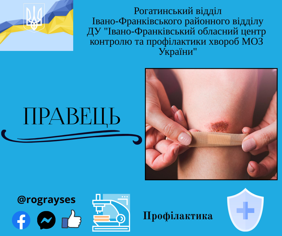 Профілактика правця