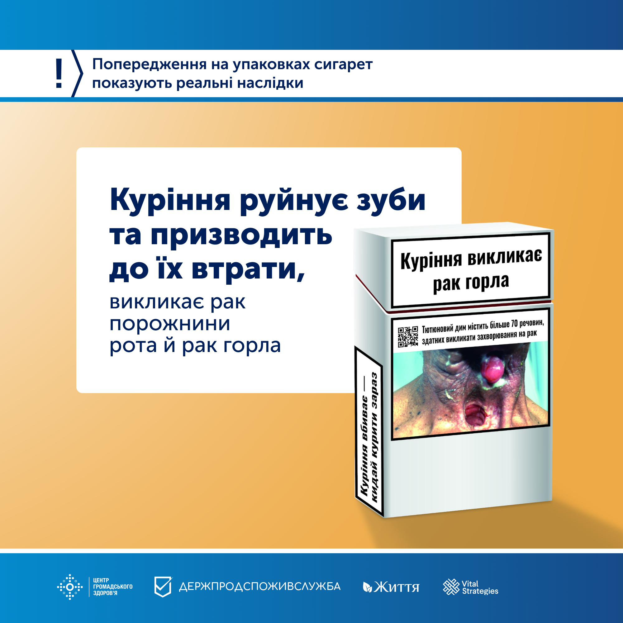  Куріння руйнує зуби та призводить до їх втрати,  викликає рак порожнини рота, рак горла